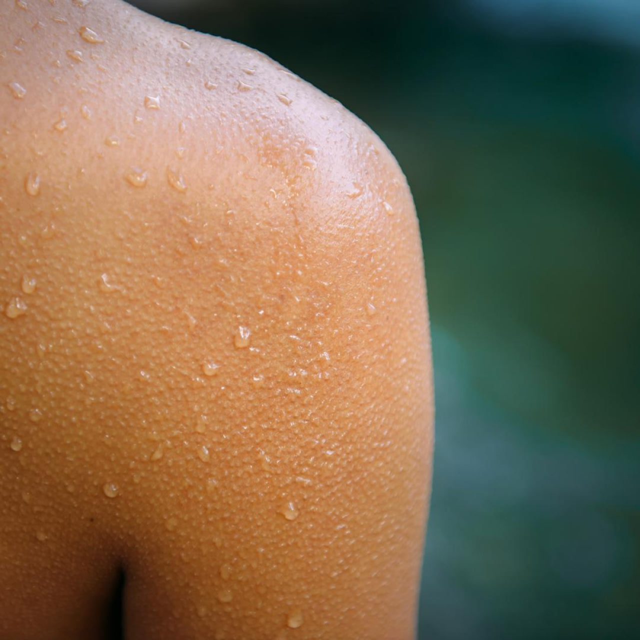 CR23B Erste-Hilfe Spray mit 98% Aloe Vera - 150 ml | Angereichert mit Kamillenextrakt